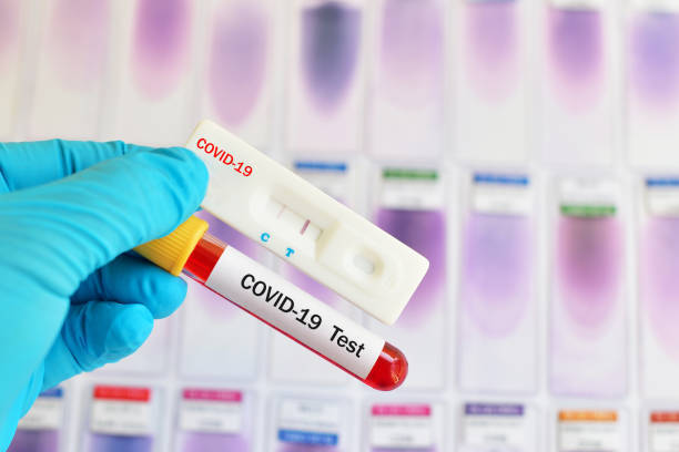 Covid Test